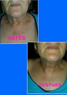 wrap facial wrap facial