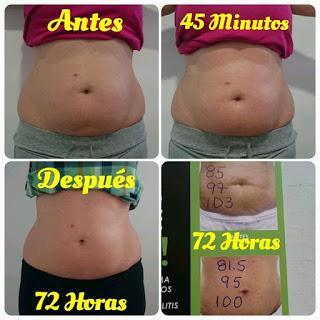 Body Wrap Abdomen Body Wrap Abdomen