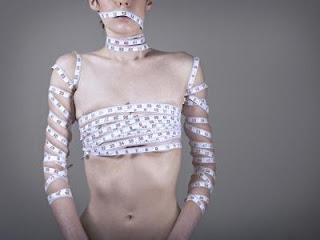 Las bacterias del intestino juegan un papel muy importamte en la anorexia