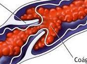 Información salva vidas (concienciando sobre trombosis)