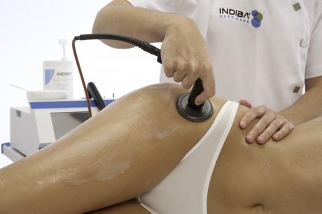 ¿Te haces un Indiba?