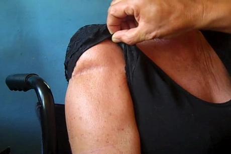 Sisley-Avila-Leon-herida-en-el-hombro