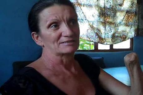 Sisley-Avila-Leon-mutilacion