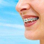 Los apoyos dentales para adultos: ¿Qué es lo que usted necesita saber?