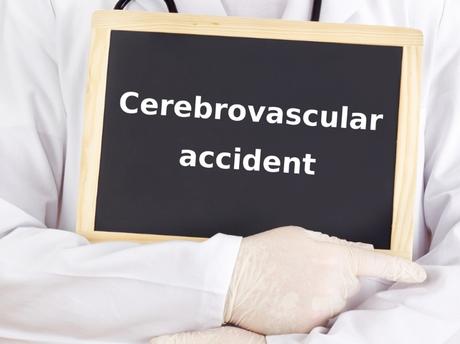 Todo sobre los accidentes cerebrovasculares