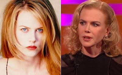 Nicole Kidman cambia de cara