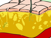 Nuestra primera defensa: piel grado