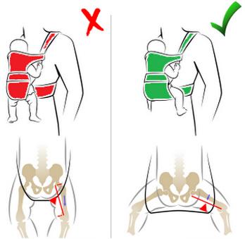 colgonas-vs-ergonomicas