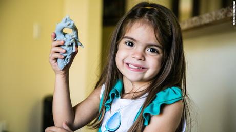 Corazón impreso en 3D cambia la vida de una niña
