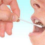 Nueva prueba de saliva puede permitir la detección temprana de la enfermedad de Alzheimer