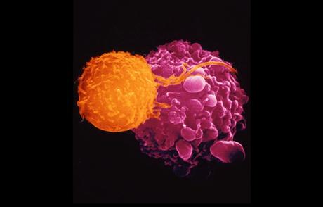 Se aprueba el uso de virus en la guerra contra el Cancer [ENG]