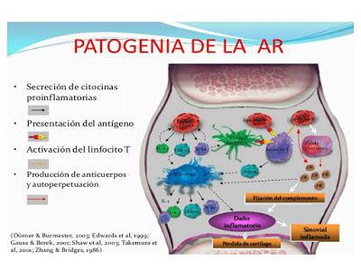 Tratamiento de la artritis reumatoide: Aspectos prácticos para el médico de familia.