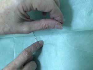 Experta en Tratamiento con Hilos Tensores:  Dra. Lourdes Pérez Soto.