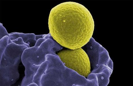 Bacterias intestinales asociadas con el asma