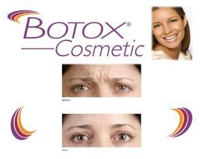 Botox