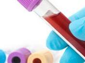 Existe posibilidad detectar varios tipos cáncer sólo análisis sangre