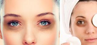 ELIMINA FÁCILMENTE LAS OJERAS CON ESTE INGREDIENTE NATURAL!!