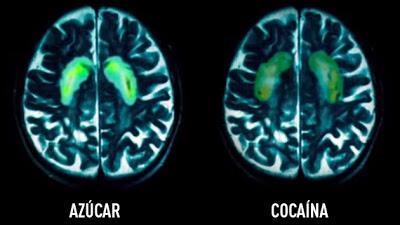 Las grasas y el azúcar son tan adictivos como la cocaína, el tabaco o el alcohol