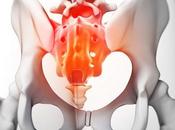 causas comunes dolor coxis (coxidinia)