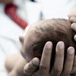 ¿Podría su bebé tener tortícolis congénita? Los signos a tener en cuenta