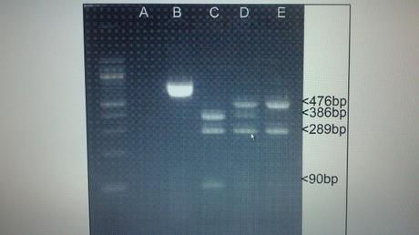 PCR-RFLP