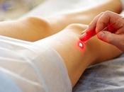 Varices: ¿Debe usted considerar cirugía láser?