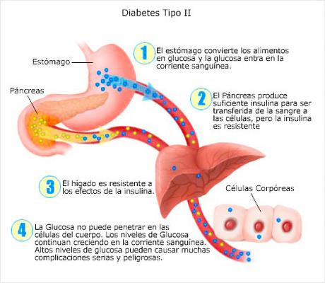 5 Razones para Seguir una Dieta para Diabeticos Tipo 2