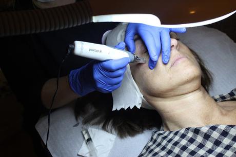 TRATAMIENTO ANUBISMED EN +SALUD+BELLEZA