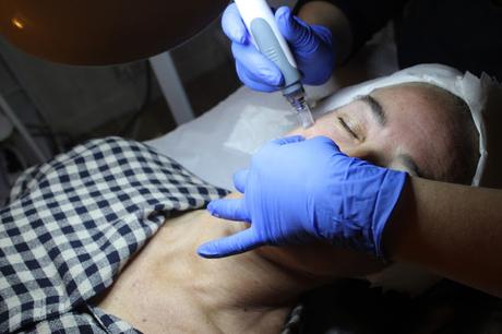 TRATAMIENTO ANUBISMED EN +SALUD+BELLEZA