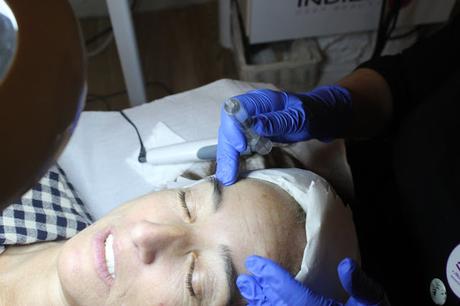 TRATAMIENTO ANUBISMED EN +SALUD+BELLEZA