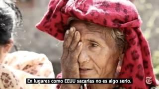 El doctor que cura a los ciegos en minutos