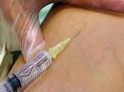 Tratamiento Esclerosante Varices