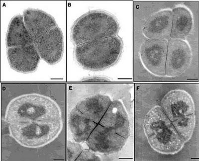 Bacterias extraterrestres: un engaño de la NASA