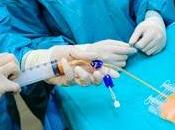 Liposucciones congelan células madre para tratar enfermedades cardiacas diabetes