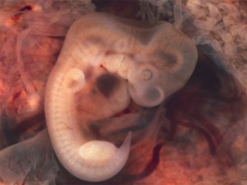 Mapa genetico fetal