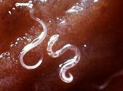 efectivos remedios caseros para lombrices