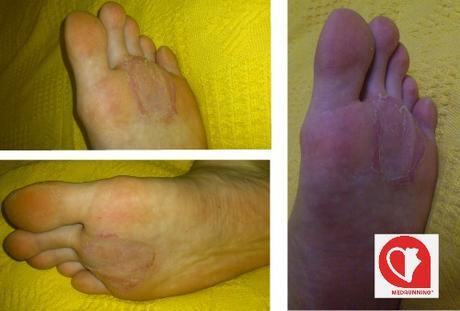 Cómo sobrevivir a los 101 de Ronda. Las Ampollas Cómo sobrevivir a los 101 de Ronda. Las Ampollas