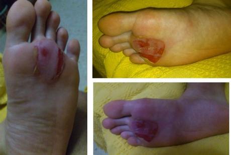 Cómo sobrevivir a los 101 de Ronda. Las Ampollas Cómo sobrevivir a los 101 de Ronda. Las Ampollas