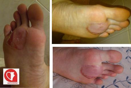 Cómo sobrevivir a los 101 de Ronda. Las Ampollas Cómo sobrevivir a los 101 de Ronda. Las Ampollas