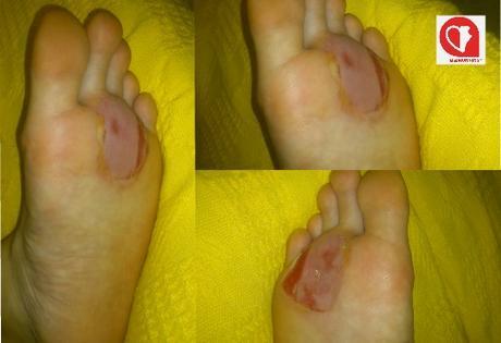 Cómo sobrevivir a los 101 de Ronda. Las Ampollas Cómo sobrevivir a los 101 de Ronda. Las Ampollas