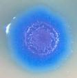 Mycoplasma Genitalium la nueva enfermedad de transmisión sexual