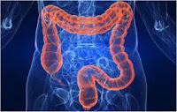 Encuentran la Causa del Sindrome de Intestino Irritable