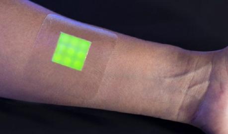 Un vendaje inteligente que detecta posibles infecciones de las heridas