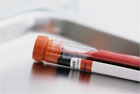 Las pruebas de sangre son una efectiva manera de diagnosticar los gusanos del corazón
