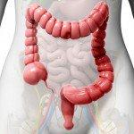 La enfermedad de Crohn y la colitis ulcerosa