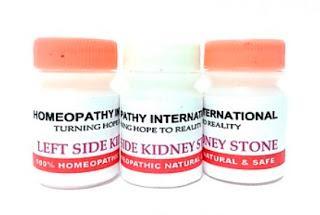 El colmo de la homeopatía renal: medicamentos distintos para piedras del riñón izquierdo y del derecho
