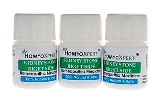 El colmo de la homeopatía renal: medicamentos distintos para piedras del riñón izquierdo y del derecho