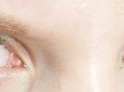 ¿Cómo proteger ojos este invierno?