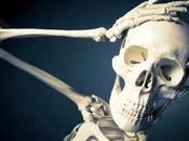 Enfermedad celíaca huesos