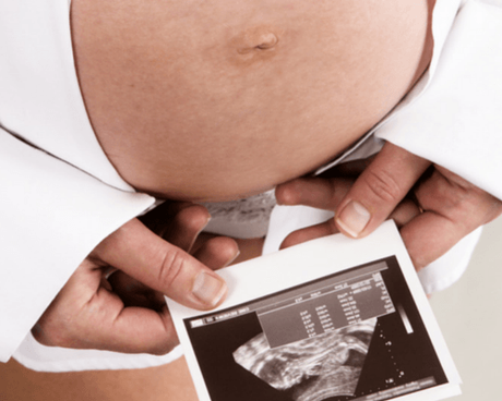 8 aspectos a tener en cuenta para planificar un embarazo sano